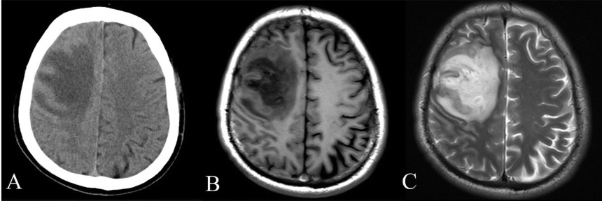 An AI Reads Your MRI in 20 Seconds. It Still Needs You.