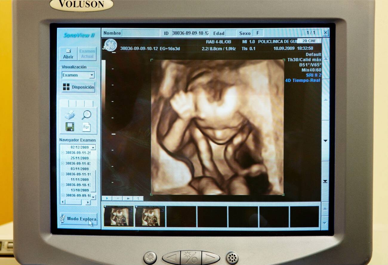 DELPHI-2M: The Dataset Quietly Changing Medical AI