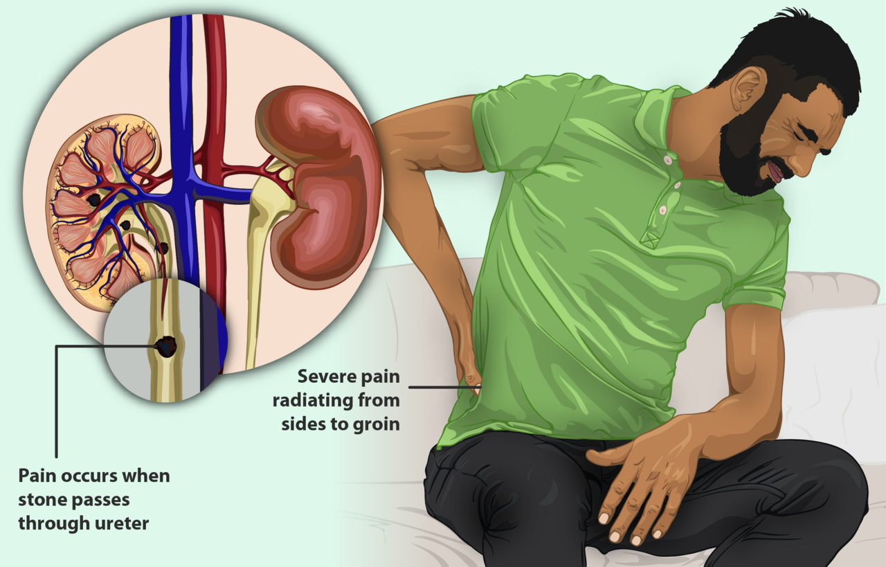 Your Kidney Function Results Decoded: What eGFR and Creatinine Numbers Mean