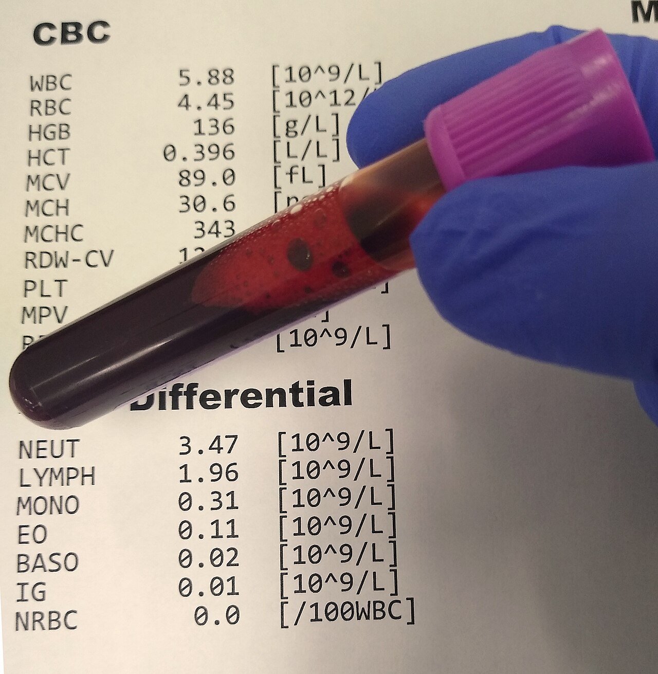 Lab Results: 12 Numbers That Actually Matter (2026)