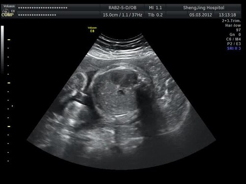 Pregnancy Health: Essential Tests, Warning Signs, and AI Support