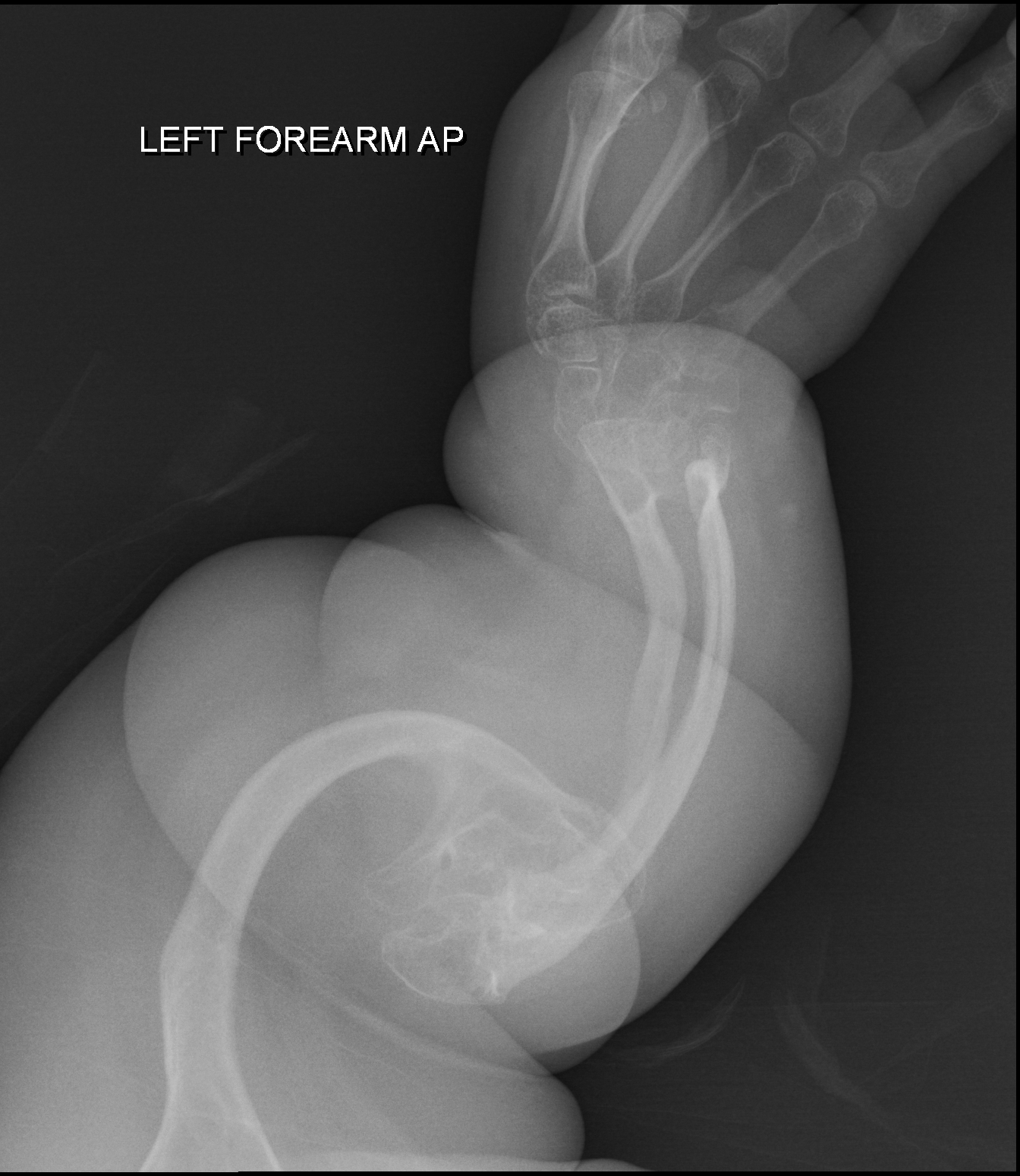 Which Medical Specialty Will AI Replace First? (2026)